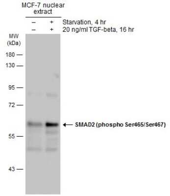 Western Blot: Smad2 [p Ser465, p Ser467] Antibody [NBP3-13273]